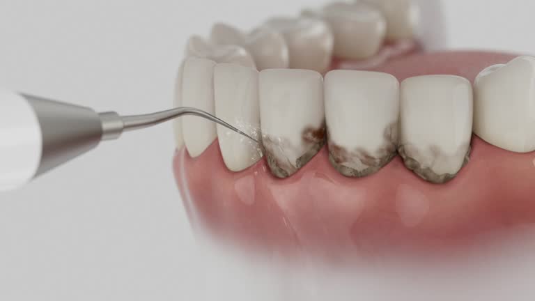 Reliable Dental Implants contractor in Riverton, IL by Smile Center Dentistry